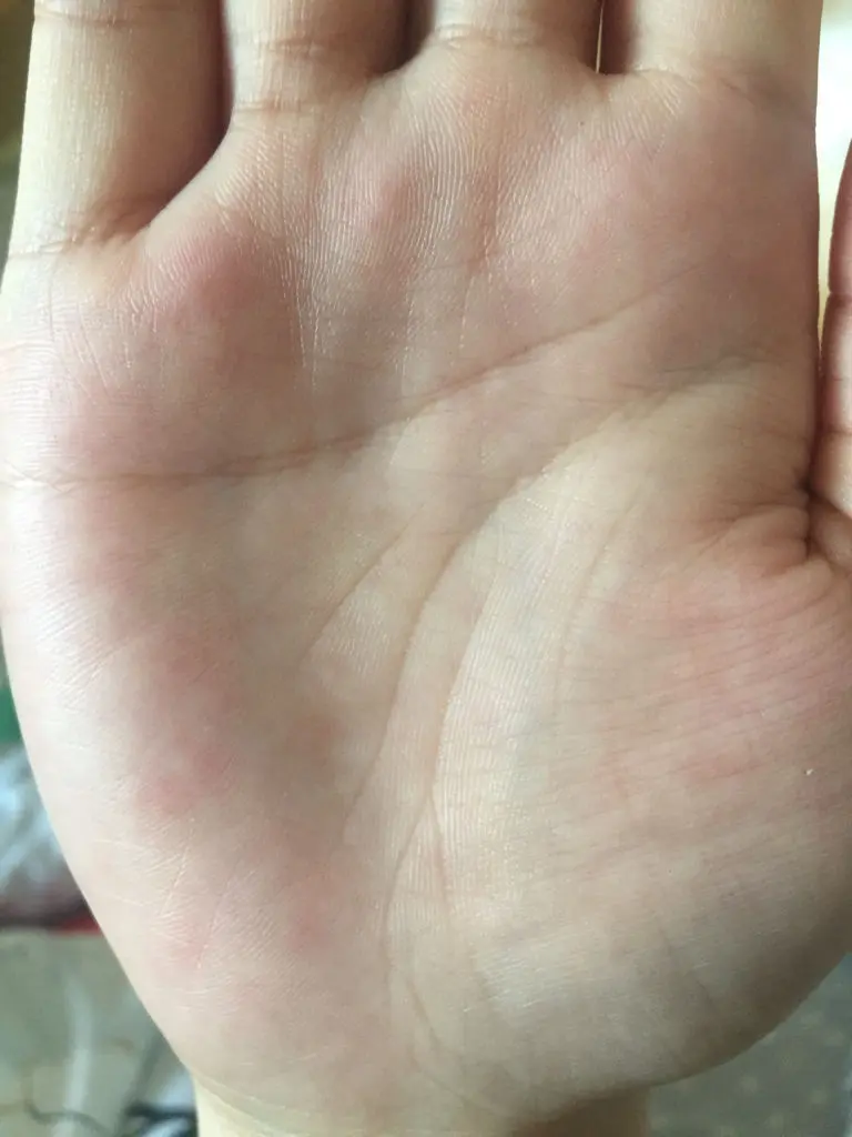 两条线