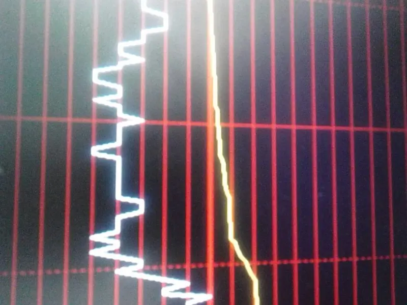 什么是“收支两条线 什么是收支两条线